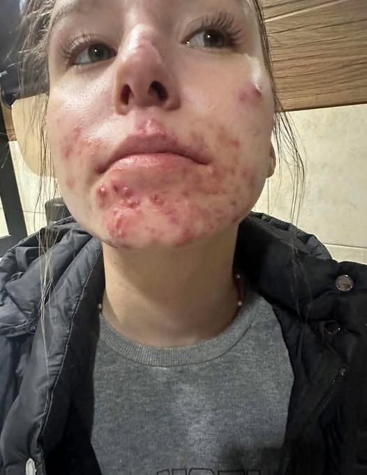 4. These are the consequences of sleeping with a… See more here