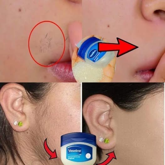 Vaseline for Facial Hair Removal