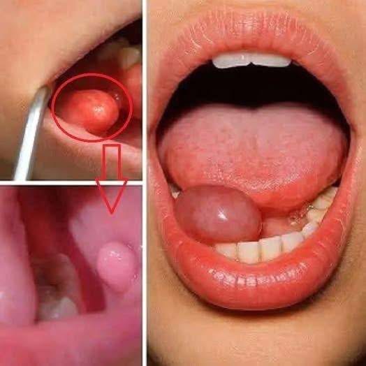 These are the first symptoms of a… See more
