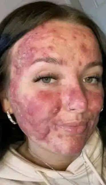Her body was itchy, he thought it was an allergy, they diagnosed him with ca…see more