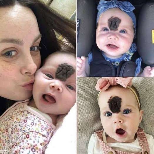 This baby girl was trolled for her looks