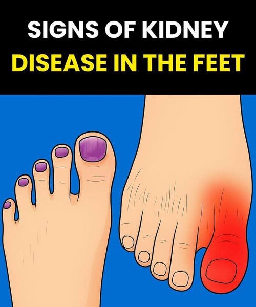 Foot Symptoms That Could Signal Kidney Problems