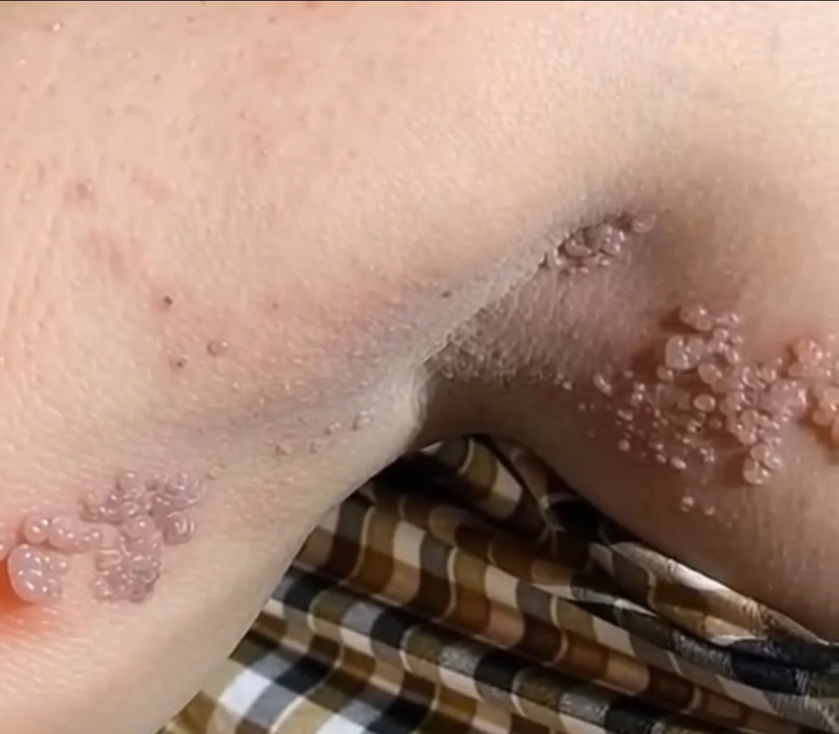 These are the consequences of sleeping co…