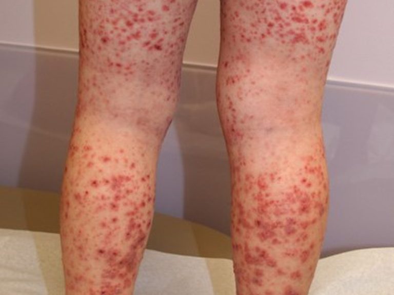 These are the consequences of sleeping with…See more