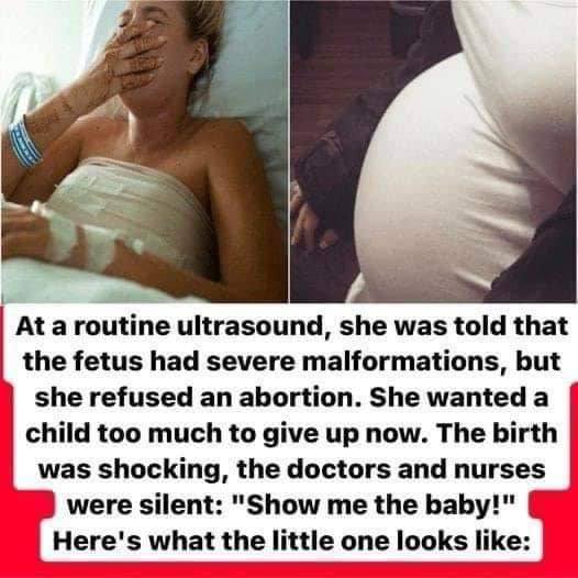 The pregnancy went normally, until, on an ultrasound, the woman was warned that she would have a baby with malformations! What happened next is incredible: Full story Check Comments 👇👇👇