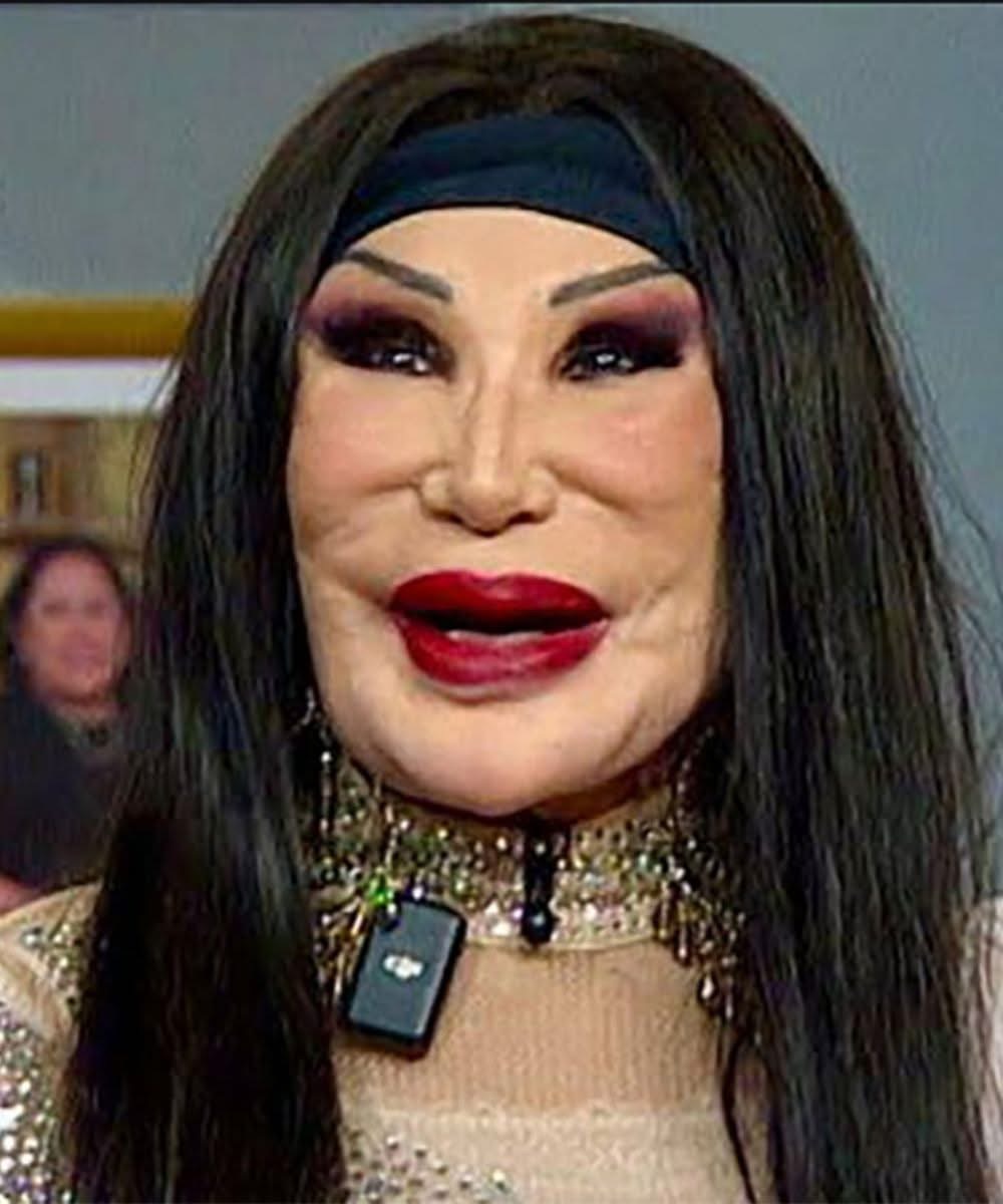 She was a famous actress, having starred in over a hundred films, but a tragic mistake completely ruined her appearance.