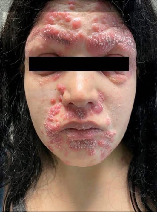 These are the consequences of sleeping with …