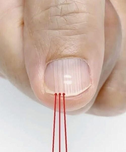 If you have these lines on your nails after 40, it is a clear sign that.. Check 1st comment