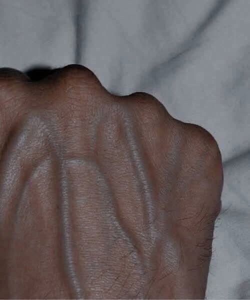 Why are your veins suddenly bulging and visible?
