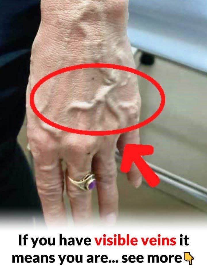 Visible Veins Explained! Normal Causes, Health Risks, and When to Worry
