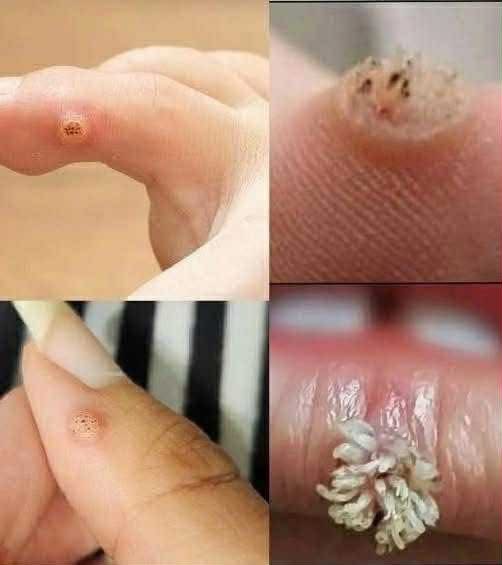 To BE VERY CAREFUL . If you get this, you are infected with …. Check the 1st comment