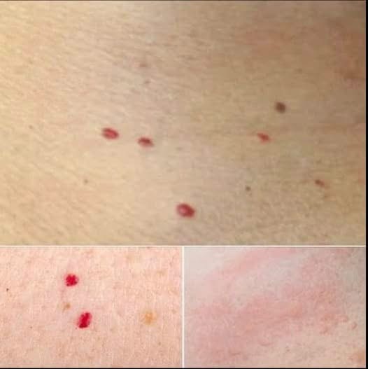 If you spot these red dots on your skin, here’s what they mean