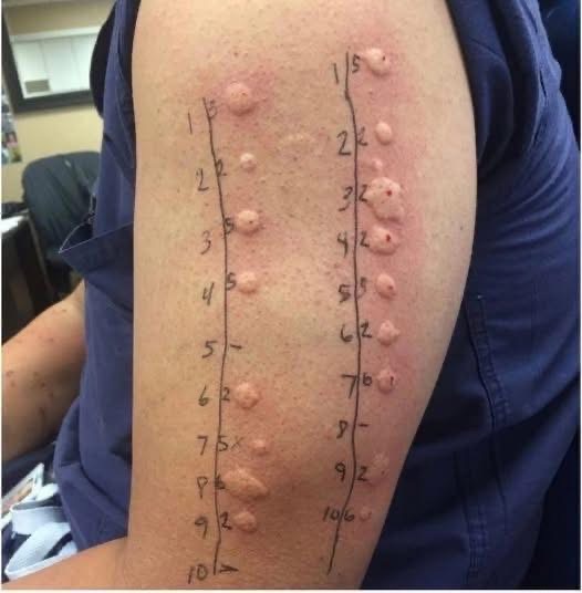 These are the consequences of sleeping with the… See more