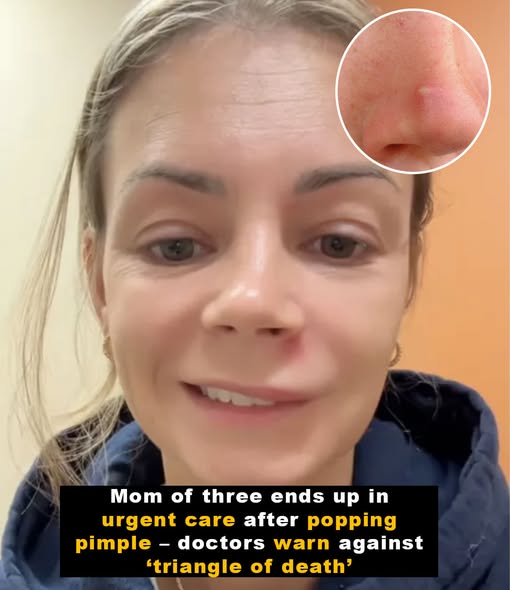 Danger Triangle Pimple Warning