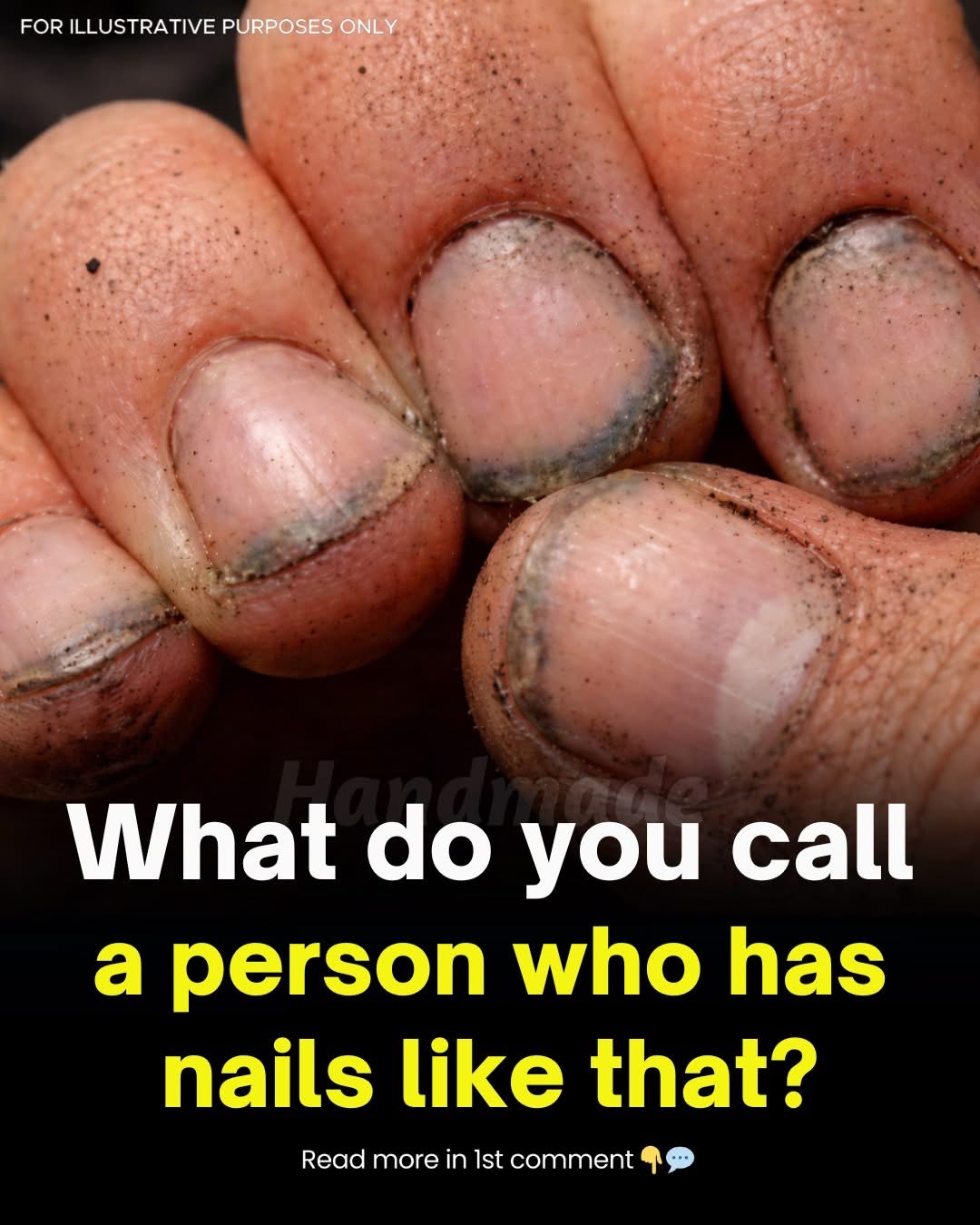 What Do Dirty Fingernails Really Say About a Person