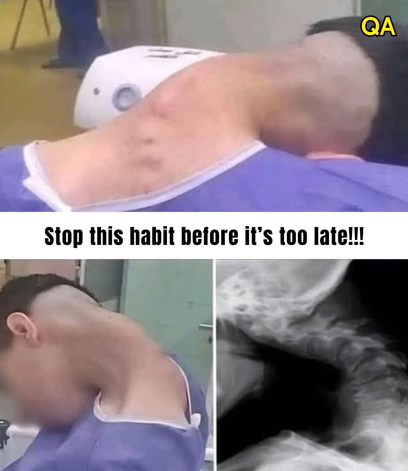 Young man hospitalized because he dropped his caโฆSee more