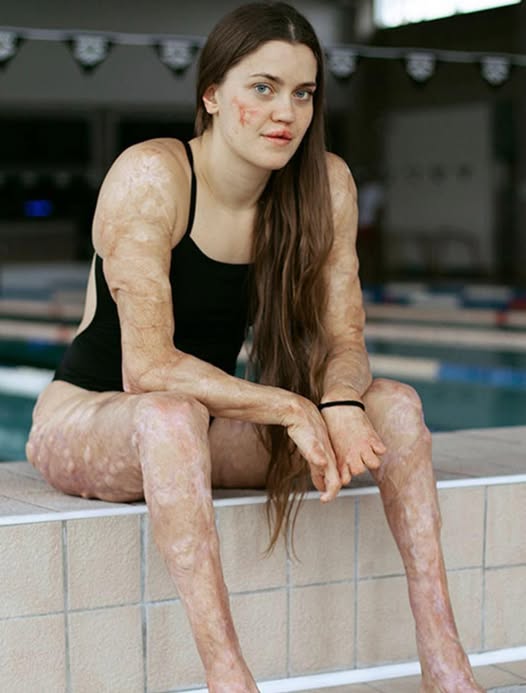 These are the consequences of sleeping co… See more