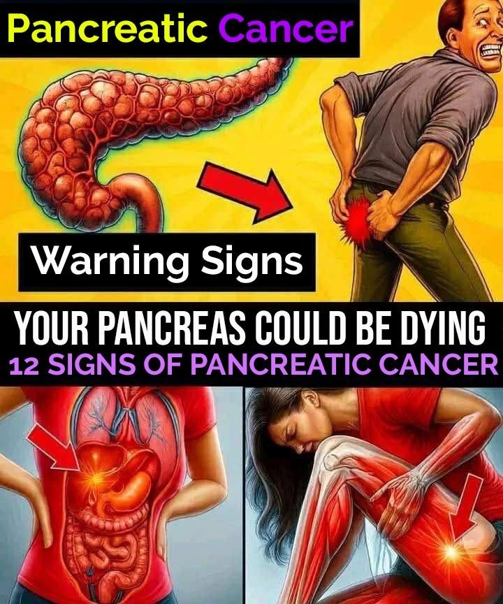 Signs of pancreatic cancer you should never ignore