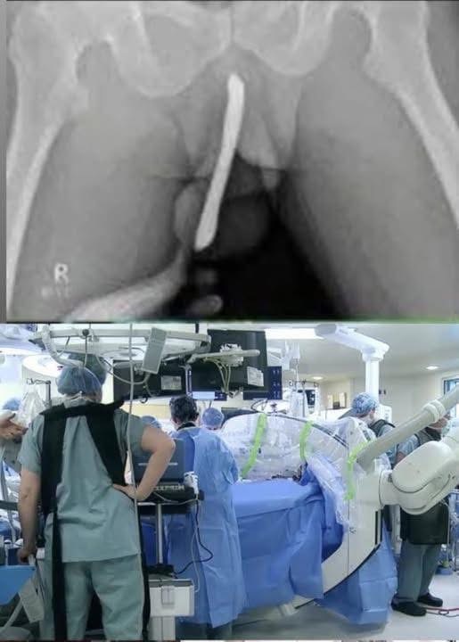 Girl had to be hospitalized for wanting to use a peโฆSee more