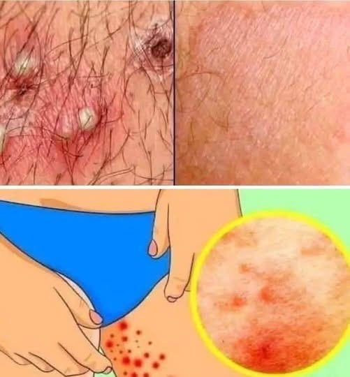 vThese are the signs that he is cr… See more