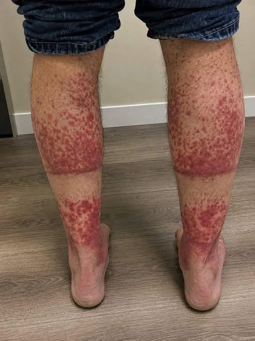 These are the consequences of sleeping with g…See More