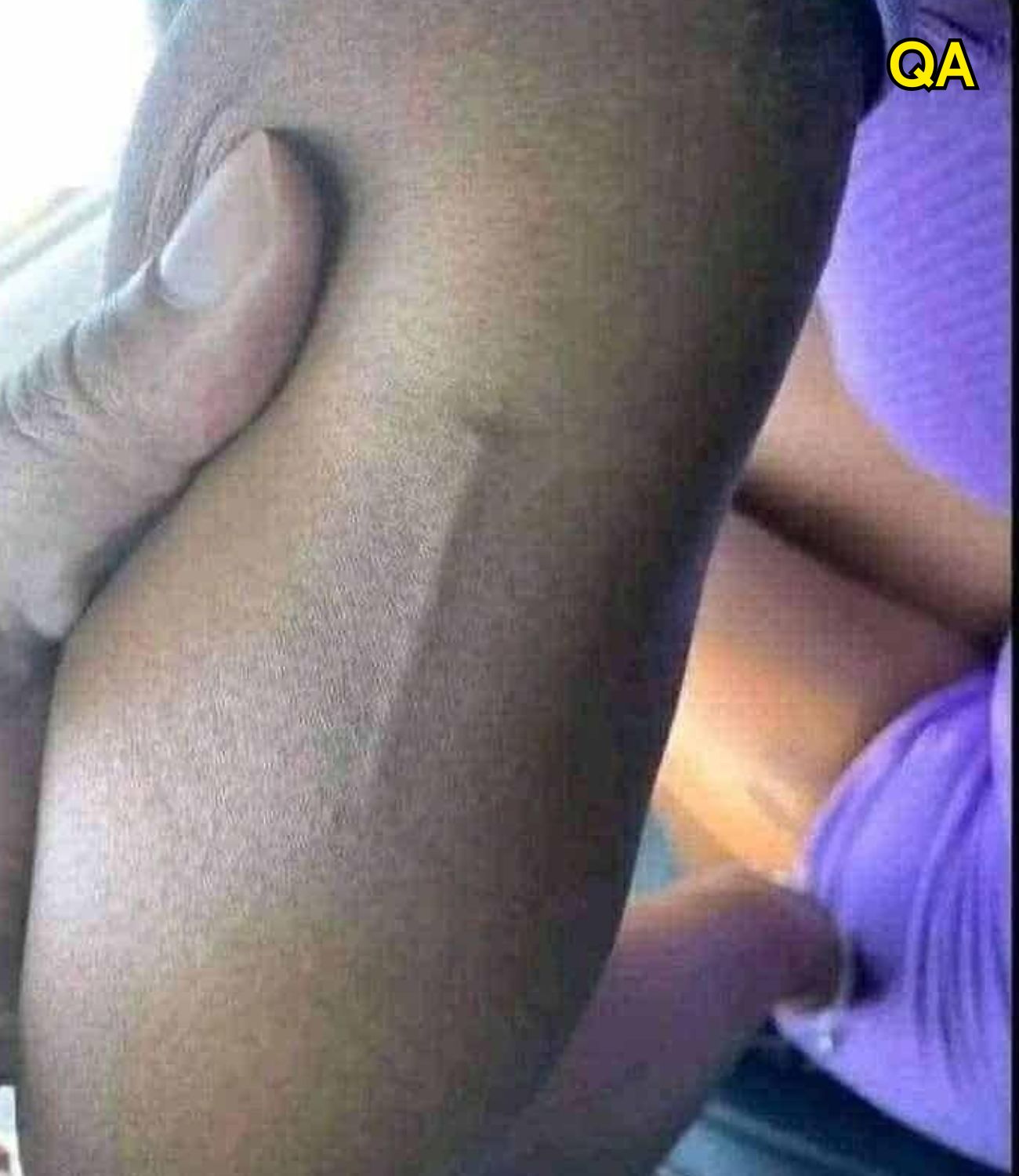 Found this in my girls arm still trying to figure out what it is
