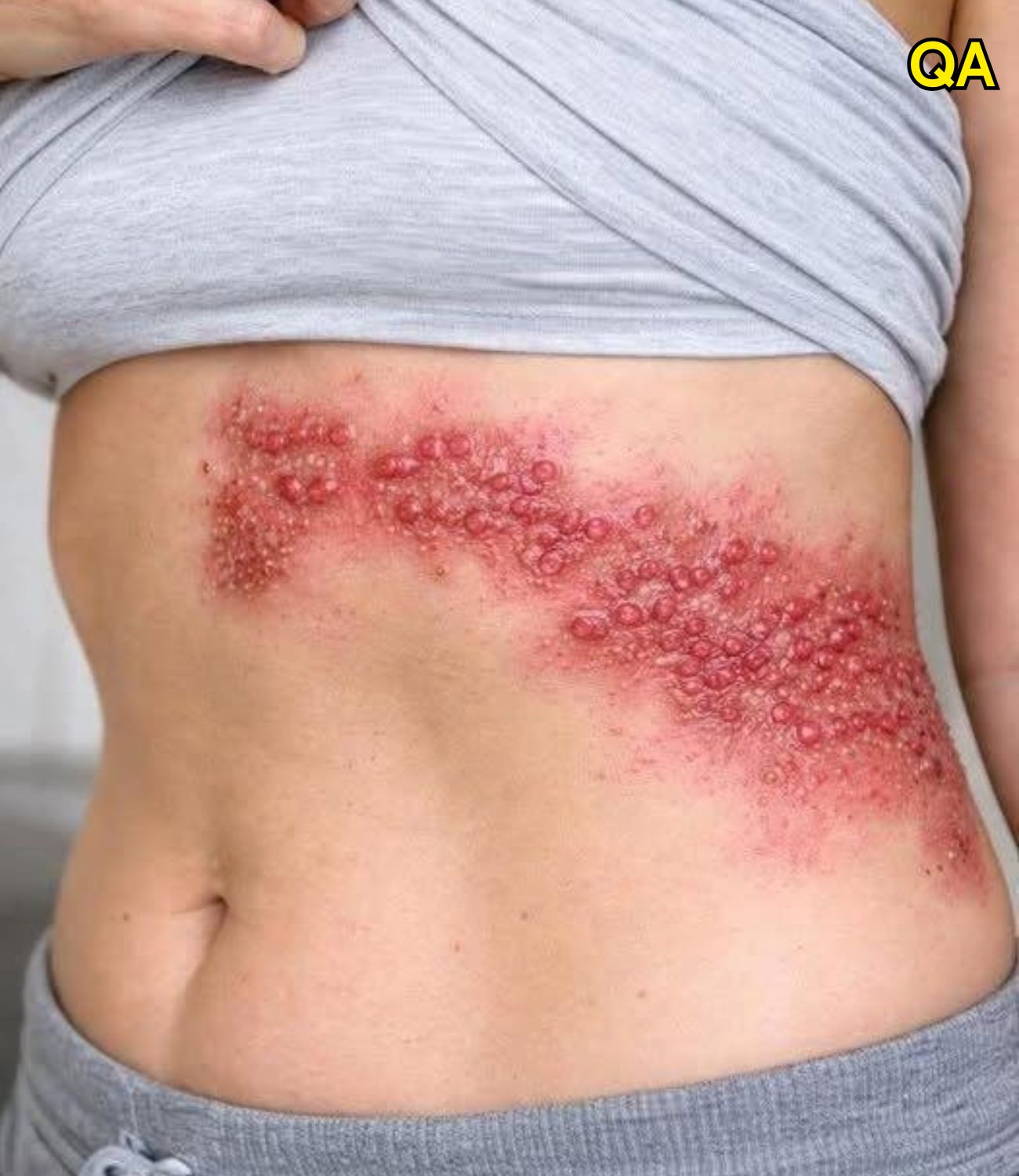 These are the consequences of sleeping with your cโฆ