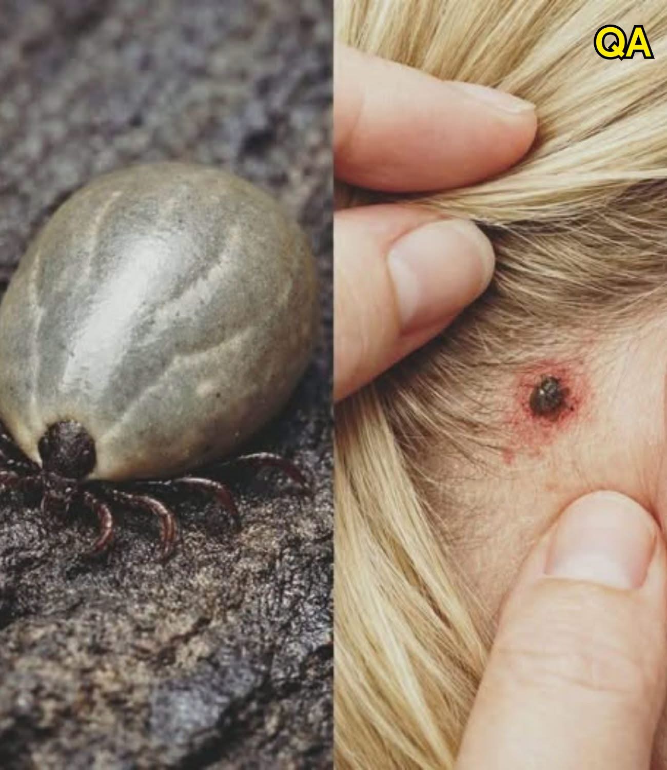 Found a Weird Bug in Your Childโs Hair? Important Info for Parents