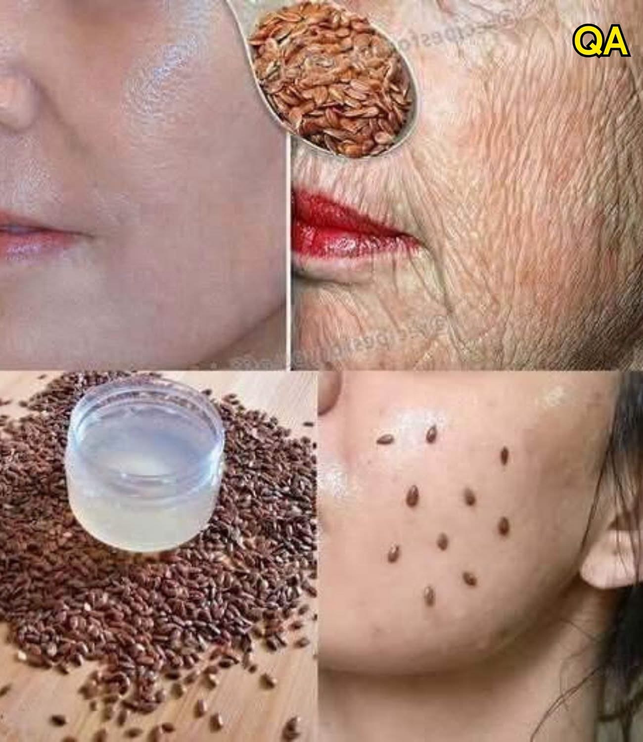Even At The Age Of 70, Apply It To Wrinkles โ And Your Facial Skin Will Become As Tight As Glass! Stronger Than Botox!