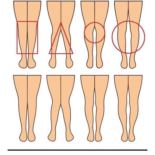 What Your Legs May Be Revealing About Your Health: Surprising Signs You Shouldn’t Ignore