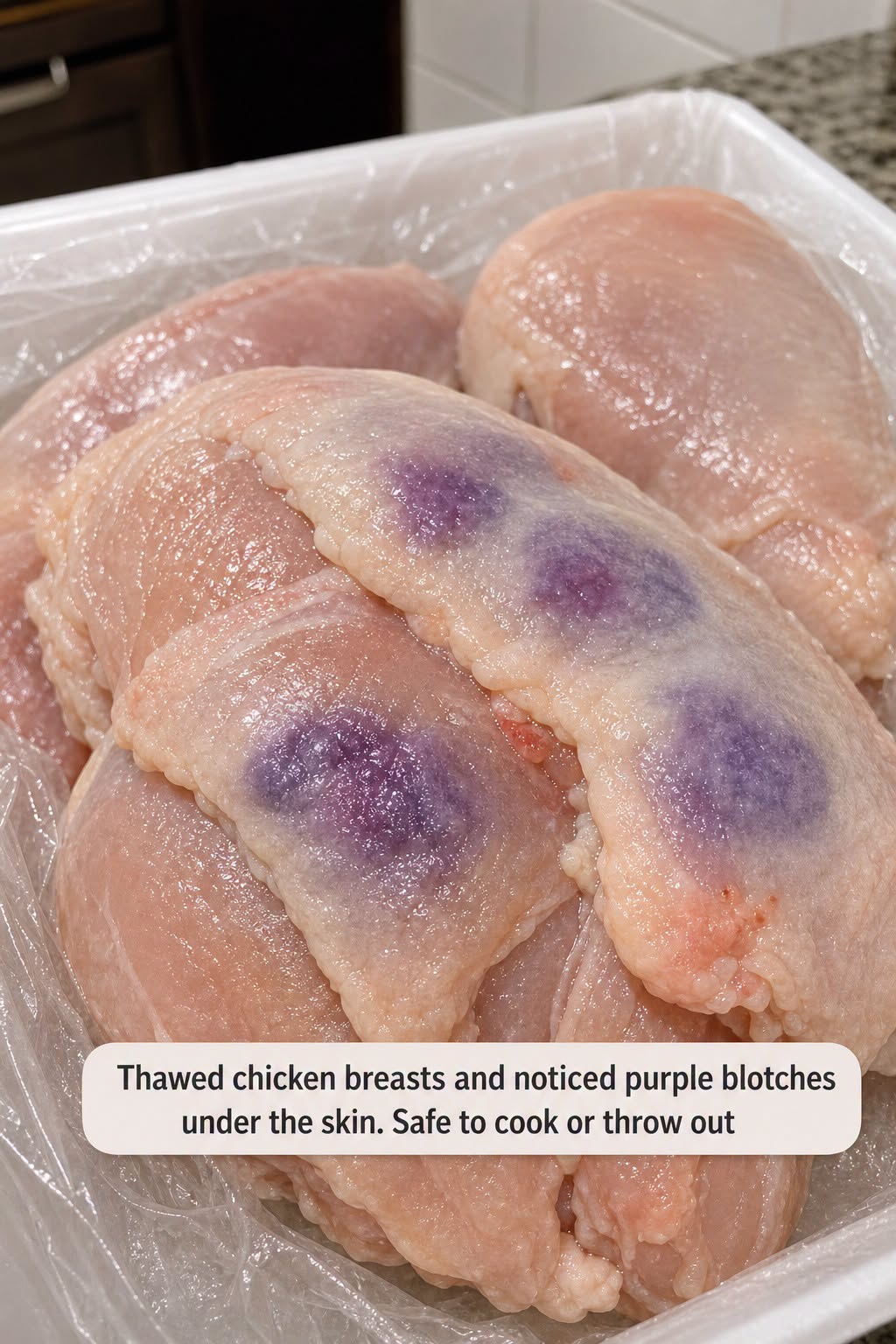 Thawed chicken breasts and noticed purple blotches under the skin. Safe to cook or throw out