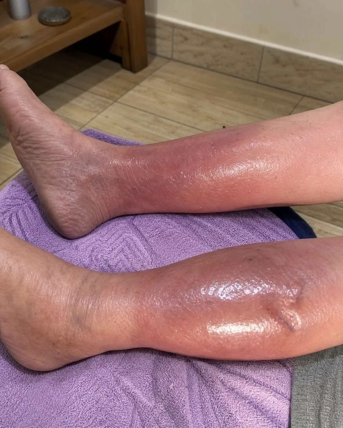 One Month Before A Heart Attack, Your Feet Will W.arn You Of These 6 Signs