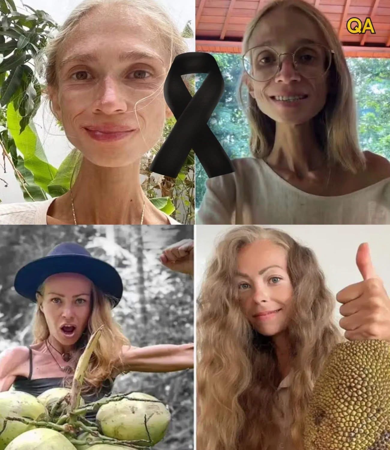 Dancer Adopts An Extreme Diet, Eats Only Fruit, Reaches 22 Kilos And Diesโฆ See More