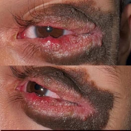 If You Always Sleep With aโฆ, Pay Attention to These Possible Effects
