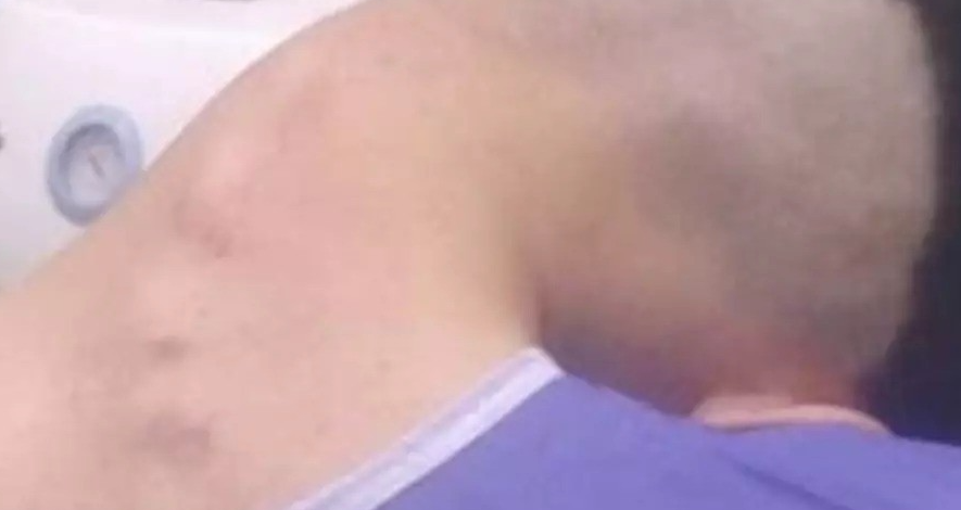Young man hospitalized because he dropped his