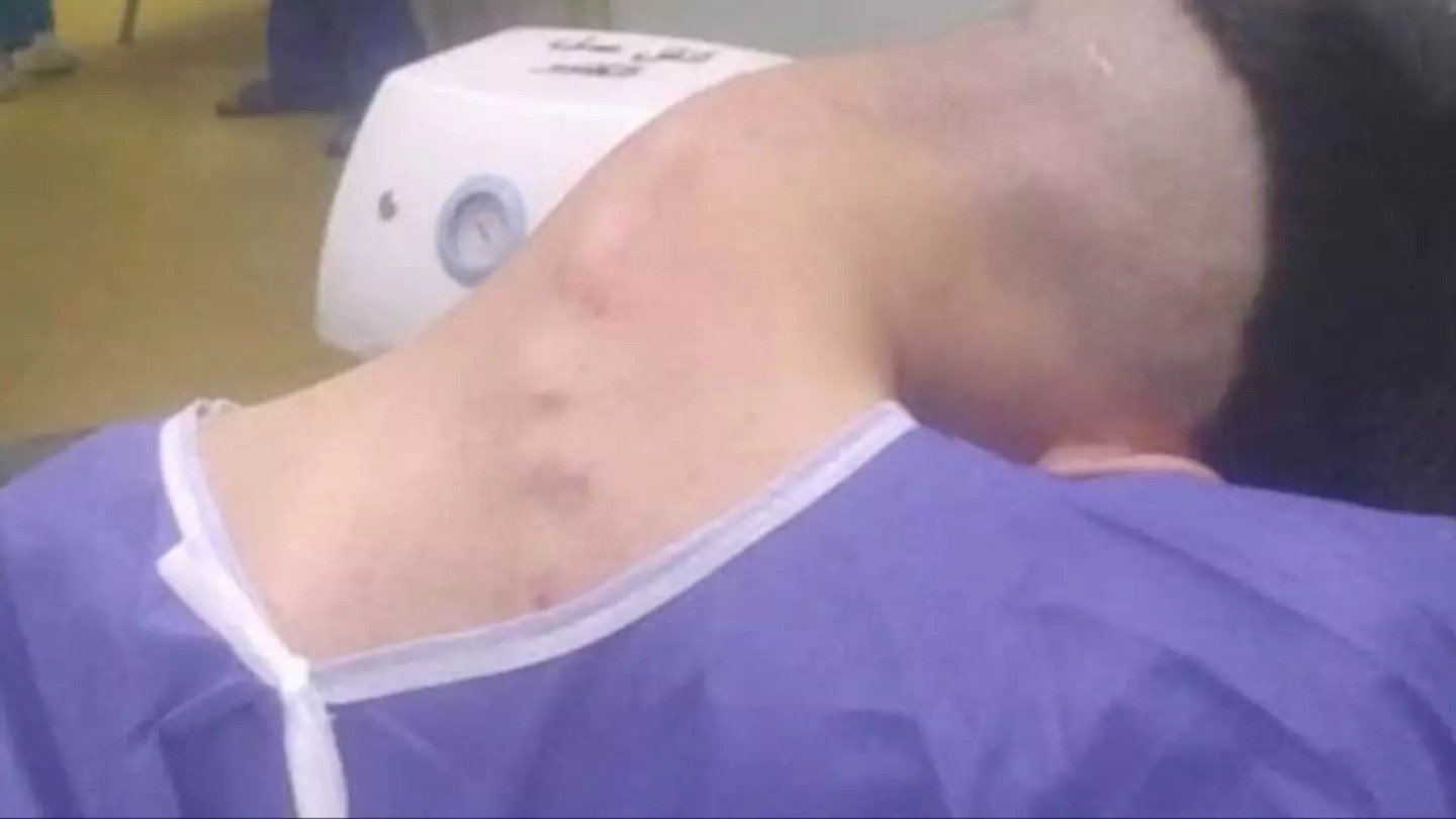Young man hospitalized because he dropped his